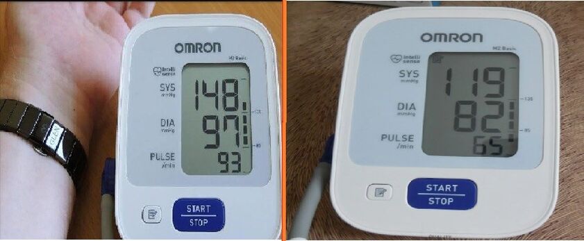 tanometer reading before and after taking Cardione